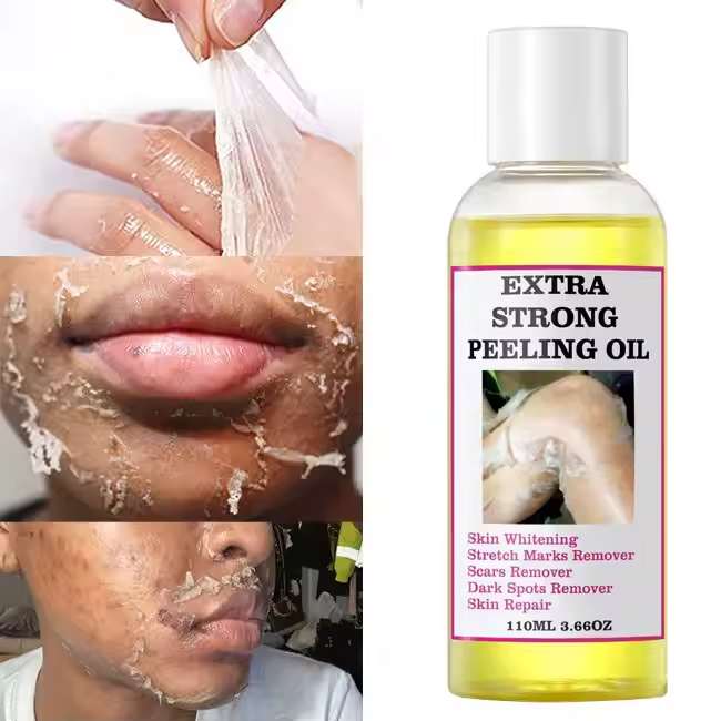 Extra Strong Peeling Oil – La Révélation pour une Peau Neuve en 3Jours