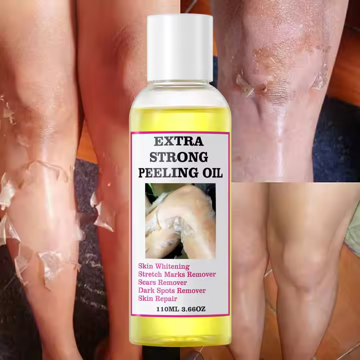 Extra Strong Peeling Oil – La Révélation pour une Peau Neuve en 3Jours