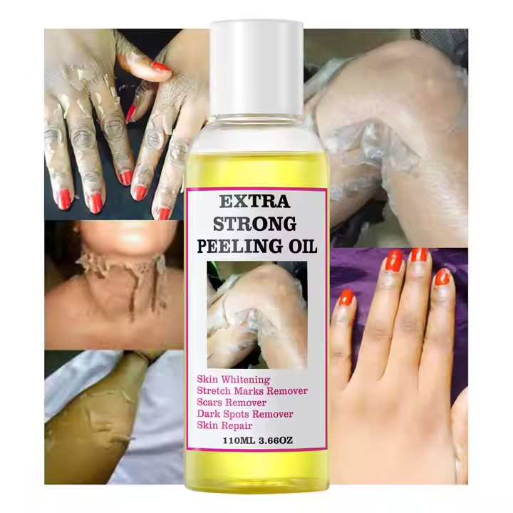 Extra Strong Peeling Oil – La Révélation pour une Peau Neuve en 3Jours