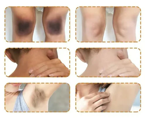 Gommage Exfoliant Greteam – Dites adieu aux zones sombres et aux complexes